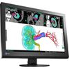 Hình ảnh EIZO RadiForce MX242W 2.3MP 61cm (24.1") Color LCD Monitor